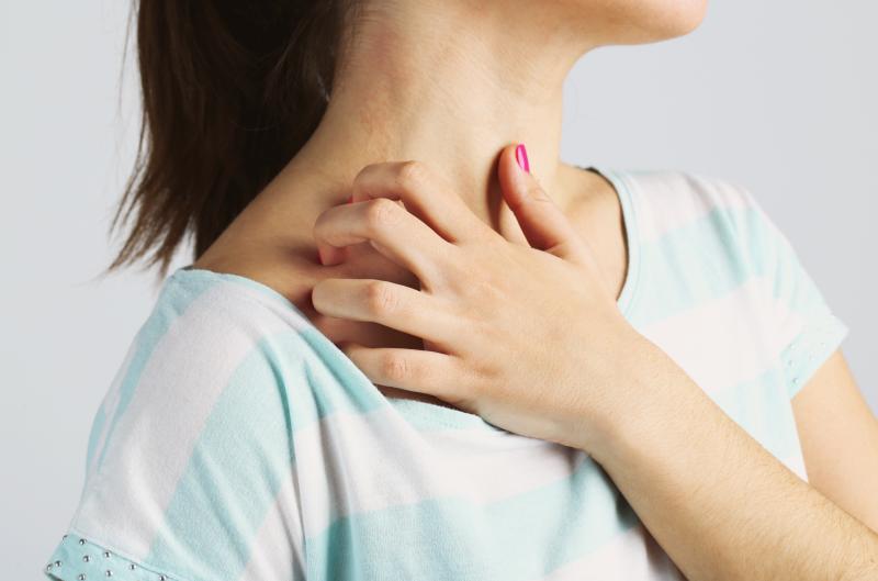 Co zhoršuje lupénku? Těchto 7 spouštěčů byste měli znát