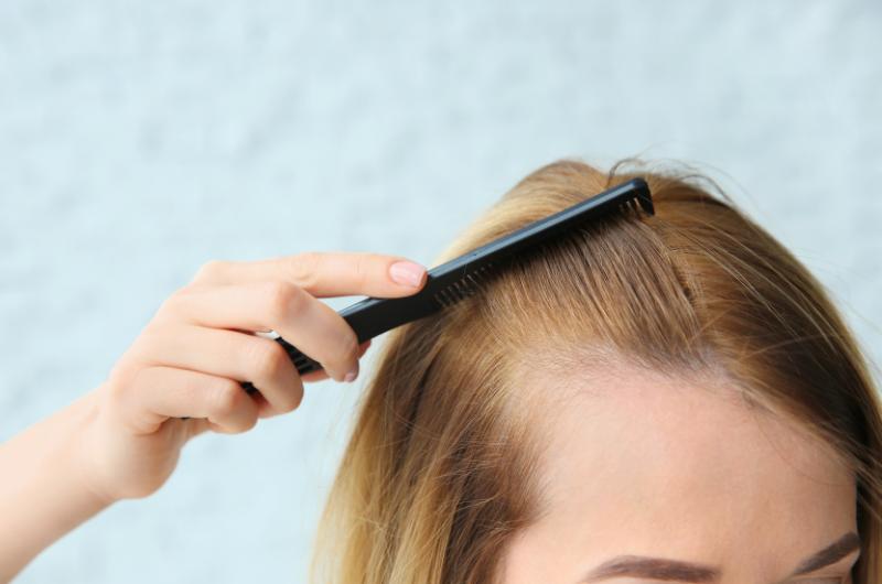 Podzim ničí jemné vlasy ženám po 40. Tohle přestaňte dělat okamžitě!