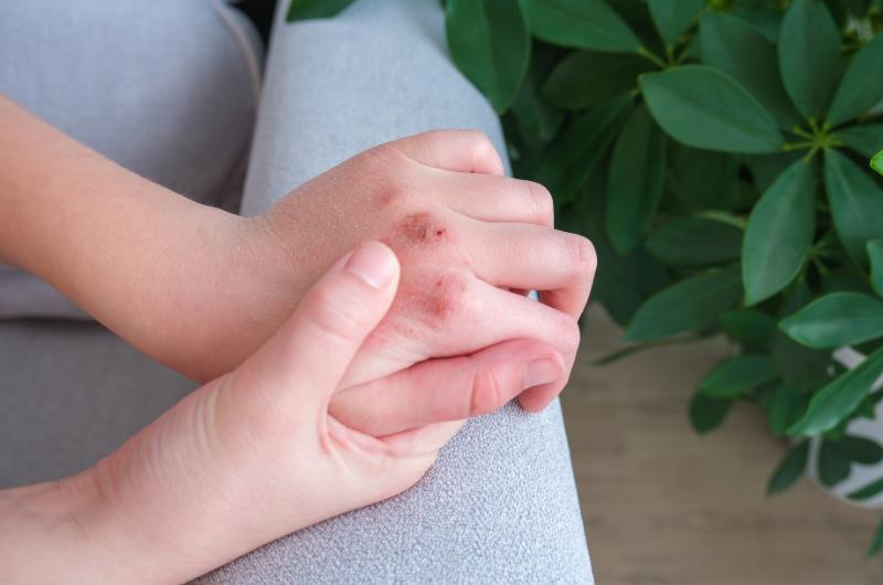 Zima dává pokožce zabrat. Odbornice varuje: Těchto 8 návyků ji ničí nejvíc