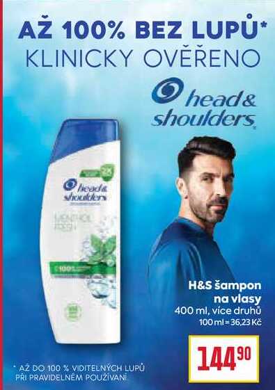 Head&Shoulders šampon na vlasy 400 ml