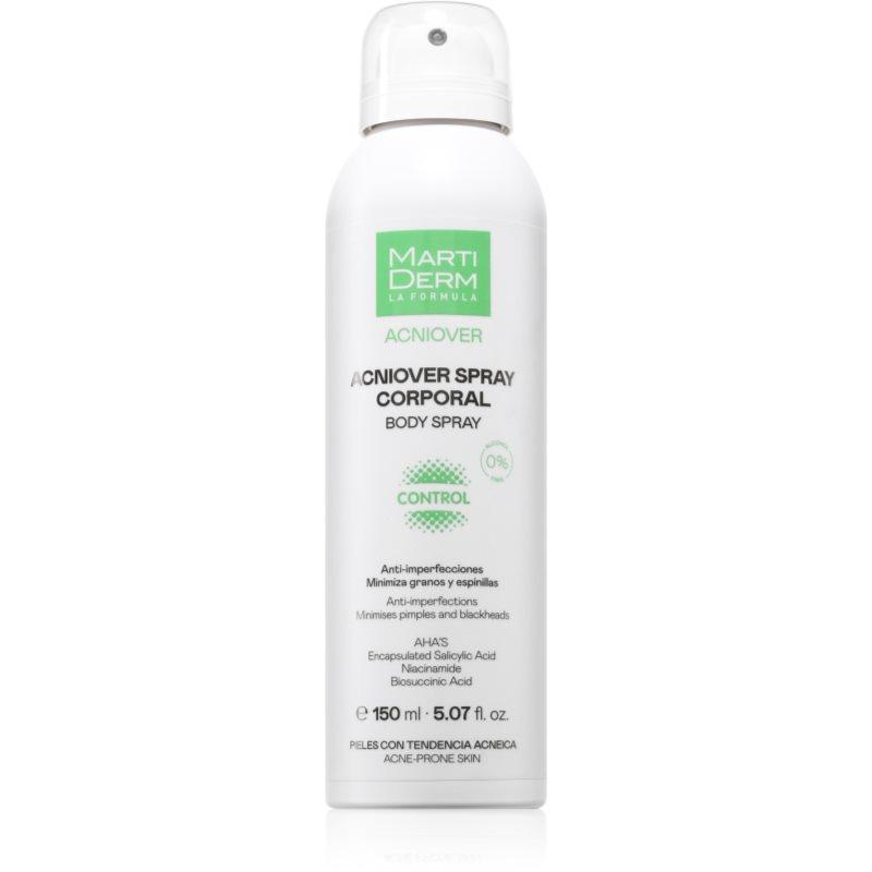 MartiDerm Acniover Body Spray tělový sprej proti akné 150 ml